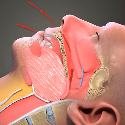 <strong>Stop aux ronflements</strong>